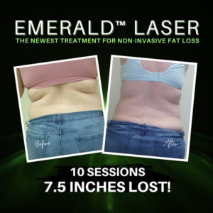 7.5 inches lost laser fat removal