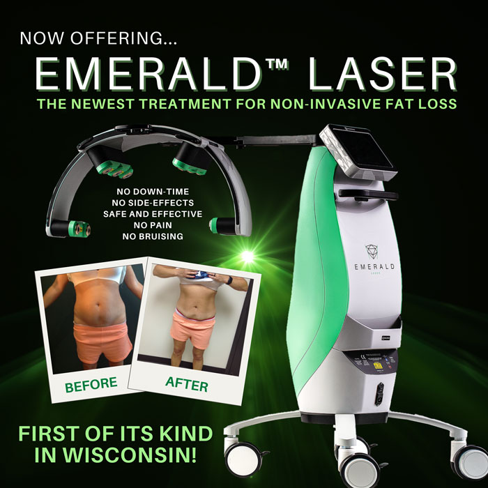 Emerald laser